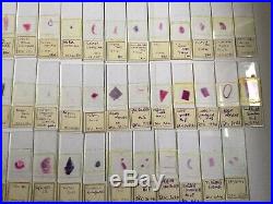 115 1941 Medical Microscope Slides Plus Vintage Medical Equipment