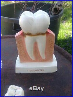 2 Vintage Crest Plaster Tooth Decay Dental Dentist Anatomical Models + 10 Teeth
