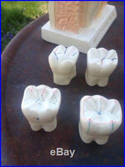 2 Vintage Crest Plaster Tooth Decay Dental Dentist Anatomical Models + 10 Teeth