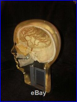 Anthropomorphic Half Angiographic Head Phantom with Step Wedge RS-245T vintage