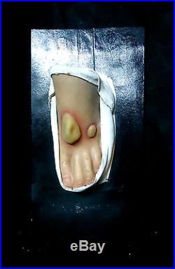Antique Medical Vintage Wax Anatomy Model Foot Pathology Moulage Museum RARE
