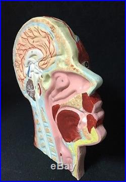 Antique / Vintage Head and Brain Section Anatomical Model