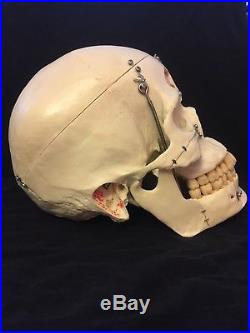 Dental Anatomy Model Skull Life Size Removable Pieces Vintage Good Condition