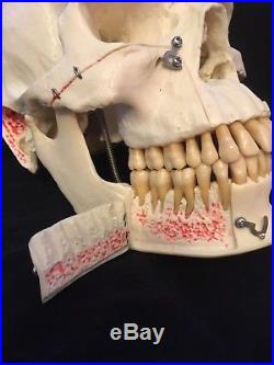 Dental Anatomy Model Skull Life Size Removable Pieces Vintage Good Condition