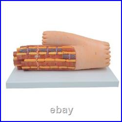 Enlarged Cardiac Muscle Model Myocardium Cell Human Anatomical Medical Equipment