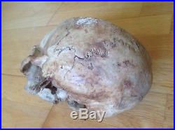 Human Medical Antique Vintage Anatomical Anatomy Skull 100% Authentic Example