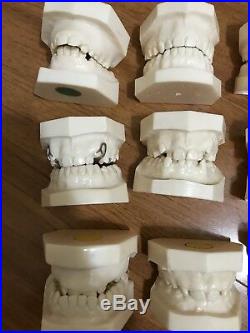 Lot Of Vintages Dental Casts