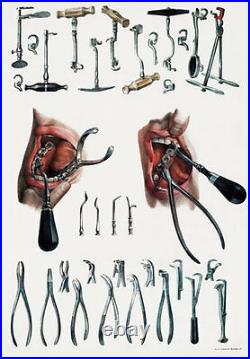 ML21 Vintage 1800s Medical Dentist Tools & Equipment Poster Re-Print A2/A3/A4