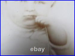 RARE 1880 Antique Cabinet Photo, CHILD HOLDING MEDICAL EQUIPMENT, Died 11 Months