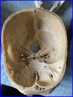 REAL Human Skull Medical Dental Teaching Training Vintage rare No Skull Cap Wow