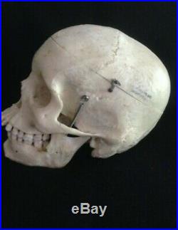REAL Human Skull Medical Dental Teaching Training Vintage rare heavy Clay Adams