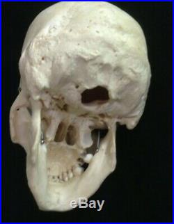 REAL Human Skull Medical Dental Teaching Training Vintage rare heavy Clay Adams