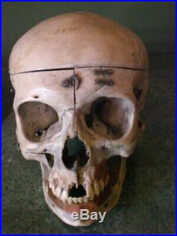 REAL Human Skull Medical Dental Teaching Training Vintage rare heavy & Old