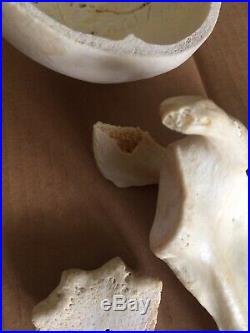 REAL Human Skull Medical Dental Teaching Training Vintage rare heavy Old Patina
