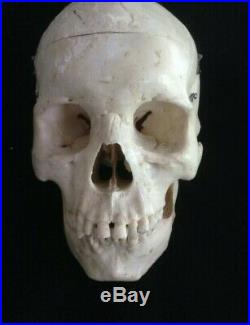 REAL Human Skull Medical Dental Training Vintage rare Clay Adams Rare Wow