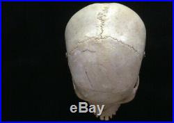 REAL Human Skull Medical Dental Training Vintage rare Clay Adams Rare Wow