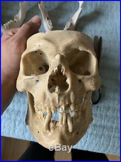 REAL Human Skull Medical Dental Training Vintage rare Old Patina NO Skull Cap