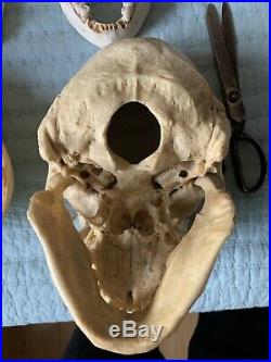 REAL Human Skull Medical Dental Training Vintage rare Old Patina NO Skull Cap