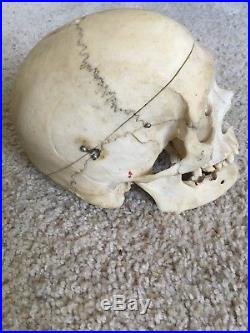 Real Vintage Human Skull Medical/ Dental Teaching/Training