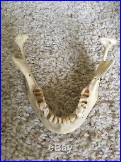 Real Vintage Human Skull Medical/ Dental Teaching/Training