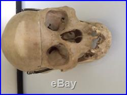 Skull Genuine Human Bone Vintage Anatomical Medical Student Learning Aide