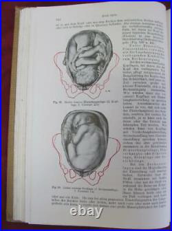 Vintage 1923 German Medical Hardcover Book Obstetrics Textbook