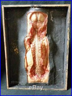 Vintage Antique Anatomical Wax Pathology Moulage Model of the back, Museum, RARE