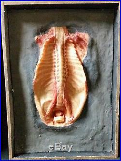 Vintage Antique Human Anatomical Wax Pathology Moulage Model, Museum, RARE