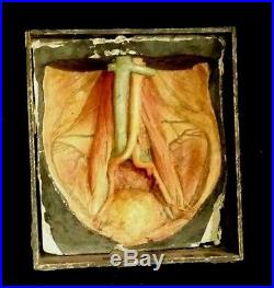 Vintage Antique Wax Anatomical Model of the Abdomen Pelvis IlioPsoas
