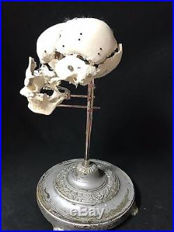 Vintage Beauchene Human Skull Model Mounted Medical Lifesize Realistic 11