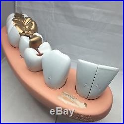 Vintage Denoyer Geppert Dental Anatomical Model Teeth Chicago 7-Part A84