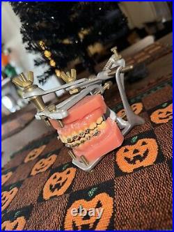 Vintage Dental Medical Articulator Device False Teeth Tool with Mold/Model