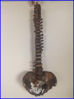 Vintage Human Medical Vertebral Spine 100% Authentic Real Human Bones