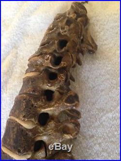 Vintage Human Medical Vertebral Spine 100% Authentic Real Human Bones