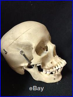 Vintage Human Skull Medical Model Some Dentition Replaced