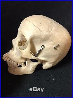 Vintage Human Skull Medical Model Some Dentition Replaced