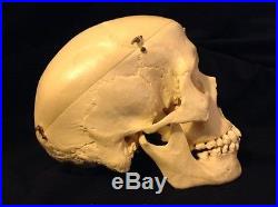 Vintage Kilgore Human Skull Model with Case This is not a real skull