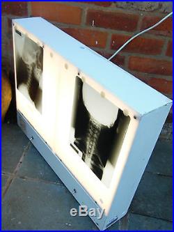 Vintage Large NHS Hospital Double X-Ray Viewer Light Box Working PAT Tested