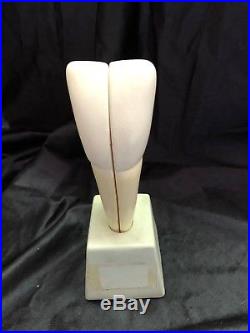 Vintage Nystrom Dental Tooth Set 5 Teeth A13 910 Anatomical Model