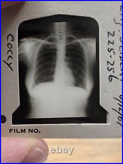 Vintage Photo Slides Kodachrome Pathology Radiology X-ray Medical Education 1950