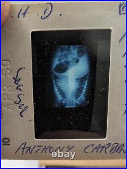 Vintage Photo Slides Kodachrome Pathology Radiology X-ray Medical Education 1950