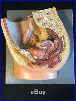 Vintage Plaster Somso MS1 Median Section Of The Female Pelvis Anatomical Model