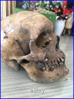 Vintage Real Human Skull Medical/ Dental Teaching/Training
