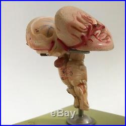 Vintage SOMSO Anatomical Model Brain MEDULLA West Germany, Original, Excellent