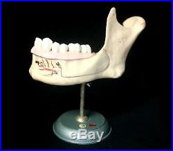 Vintage SOMSO ES4 Lower Jaw of an 18-Year-Old Anatomical Model ES 4 Dental