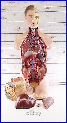 Vintage Somso 33 Human Torso Anatomical Anatomy Medical Missing Pieces