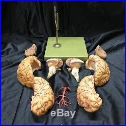 Vintage Somso BS23-1 Brain Model With Arteries 9 Parts Anatomical Model