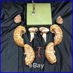 Vintage Somso BS23-1 Brain Model With Arteries 9 Parts Anatomical Model