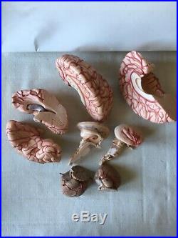 Vintage Somso Human Brain Model, Pre-owned