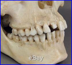 Vtg Skull Genuine Human Bone Vintage Anatomical Medical Student Dental Learning